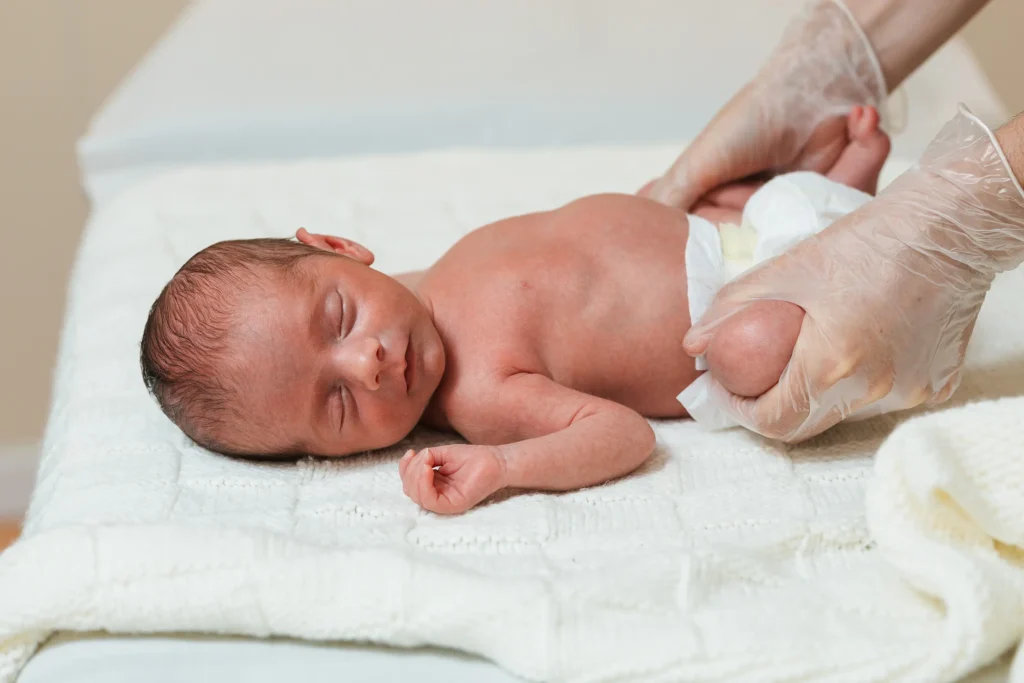 Physical therapist working with a newborn